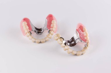 Seramik kron düzeltme ekleri ile toka protez