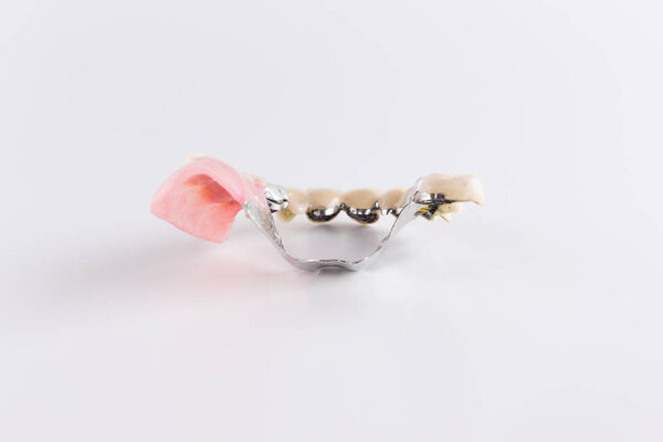 Протез застежки с креплением керамических коронок
