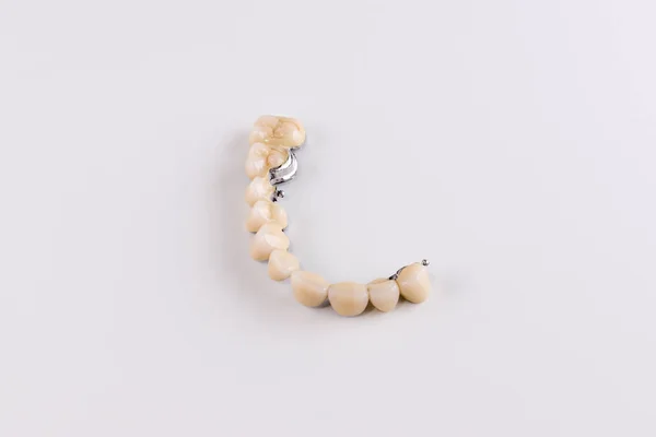 Gigi palsu yang terbuat dari keramik yang terletak pada model plester — Stok Foto