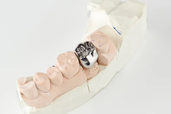 Cast metal dental crown — Stock Photo, Image