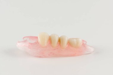 Modern naylon çıkarılabilir protez