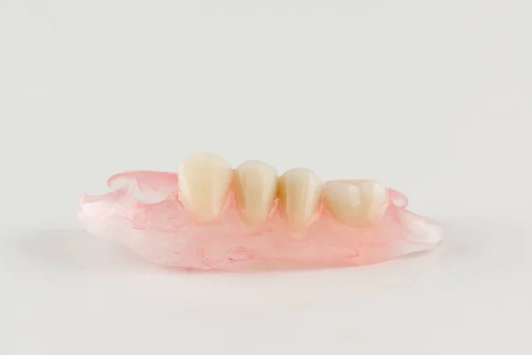 Modern nylon removable dentures — Stock Photo, Image