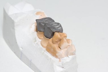 Üretim adımları içinde yapay protez