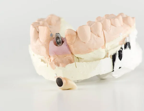 Nouvelles prothèses dentaires sur fond blanc — Photo