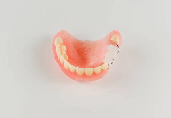 Acrylic denture with metal clasps — Stock Photo, Image