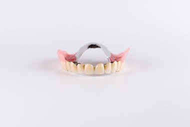 Seramik kron düzeltme ekleri ile toka protez