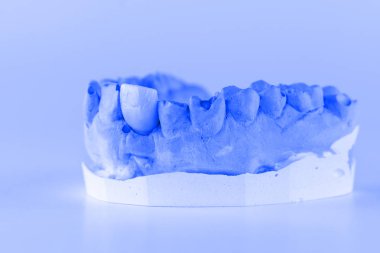 Beyaz bir arka plan üzerinde yeni protez