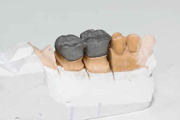 Artificial dentures in the manufacturing steps — Stock Photo, Image
