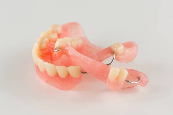 Acrylic denture with metal clasps — Stock Photo, Image