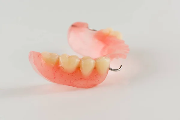 金属の留め金でレジン床義歯 — ストック写真