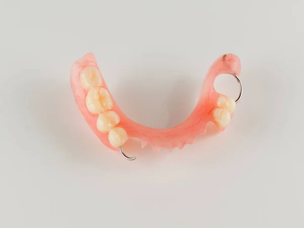 Acrylic denture with metal clasps — Stock Photo, Image