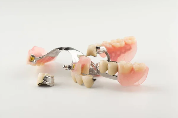 Kilit fiksasyon ile toka protez