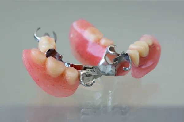 Clasp denture with a metal arc — Stock Photo, Image