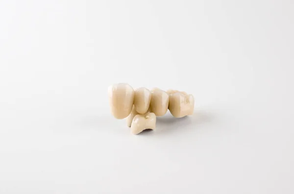 Teeth from ceramics — Stock Photo, Image