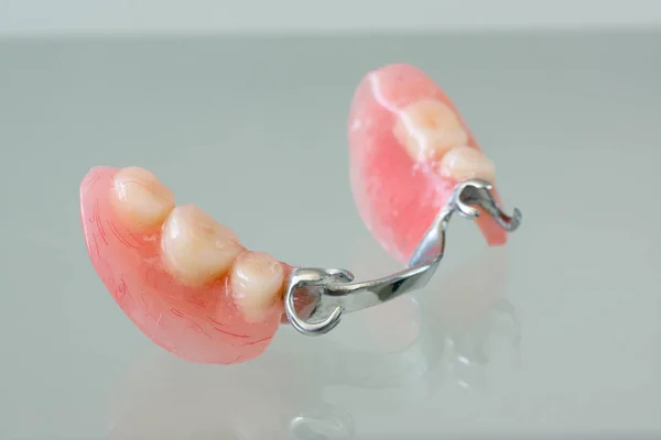 Clasp denture with a metal arc