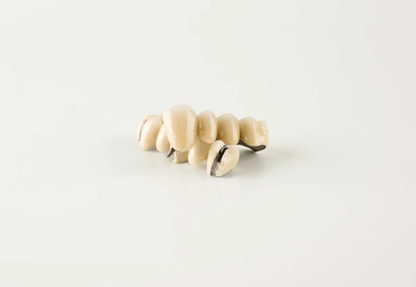 Daño de dentadura por masa cerámica — Foto de Stock