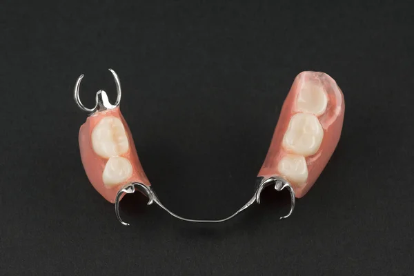Elementos de una prótesis dentales —  Fotos de Stock