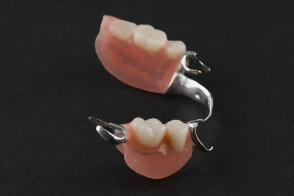 Elements of a dentures — Stock Photo, Image