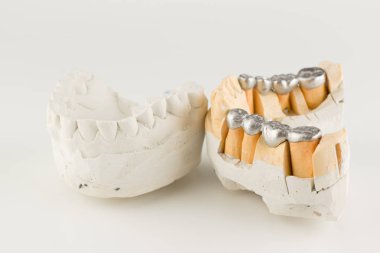 metal döküm köprüleri temelleri