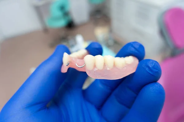 Removable denture in the hands of a doctor — Stock Photo, Image