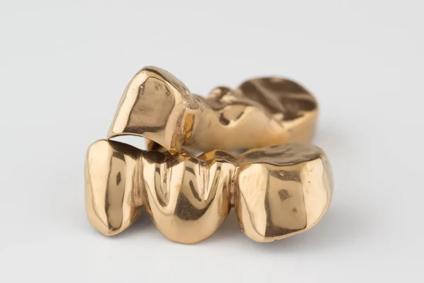 Штучний зуб корона покрита золотом — стокове фото