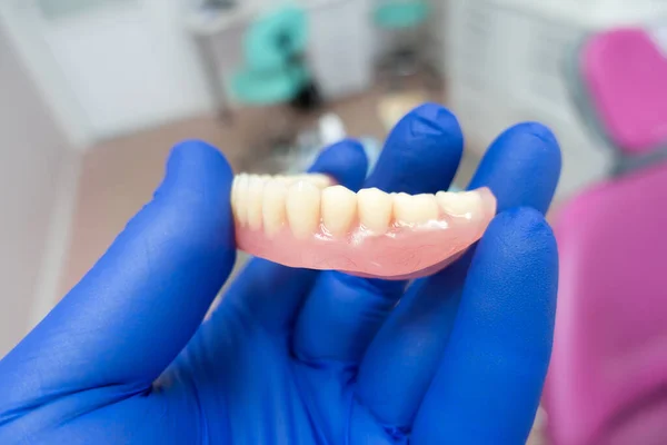 Prothèse Dentaire Amovible Dans Les Mains Médecin Gants Bleus — Photo