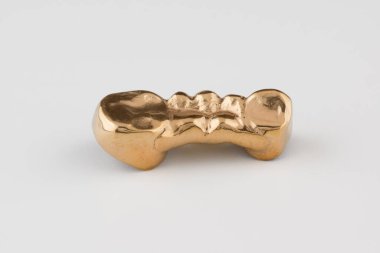 Diş kontrolü için yapay çelik kaplama.