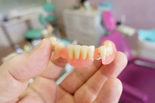 Prothèse Dentaire Amovible Entre Les Mains Médecin Dans Cabinet Dentaire — Photo