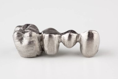 Diş kontrolü için yapay çelik kaplama.