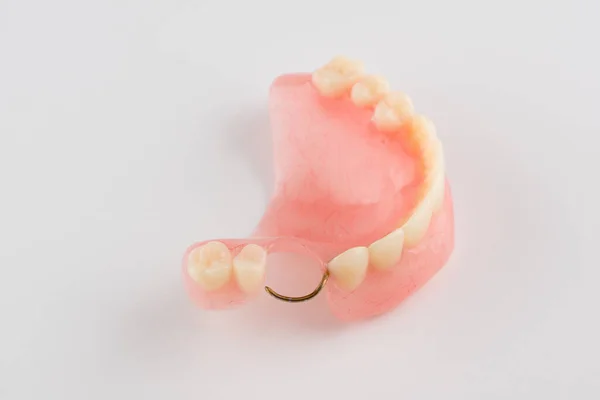 Prótese Dentária Acrílica Com Elemento Retenção Metal — Fotografia de Stock