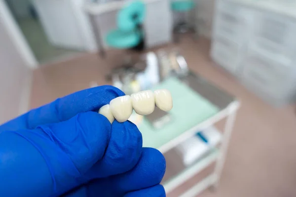 Structures Dentaires Artificielles Entre Les Mains Dentiste — Photo