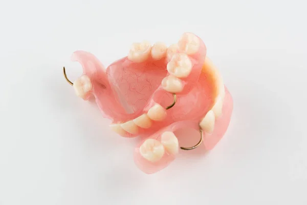 Protesi Odontoiatrica Acrilica Con Elemento Fissaggio Metallo — Foto Stock