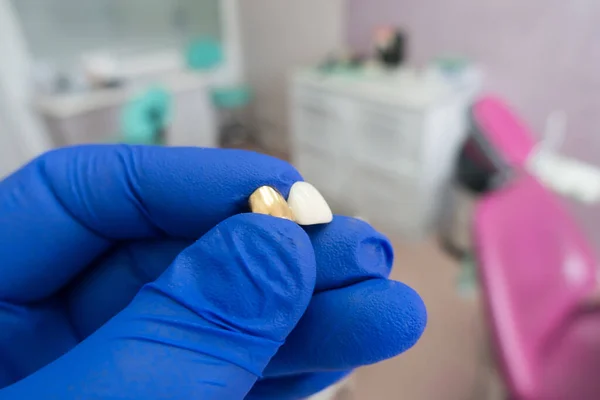 Sztuczne Struktury Dentystyczne Rękach Dentysty — Zdjęcie stockowe