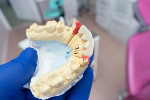 Structures Dentaires Artificielles Entre Les Mains Dentiste — Photo