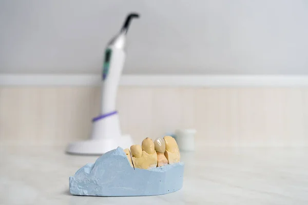 Dental Ceramic Crown Plaster Model Stands Tabl — Stock Photo, Image