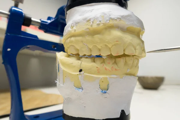 Eklem Makinesinde Alçı Modelleri Olan Bir Diş Teknisyeninin Işyeri — Stok fotoğraf