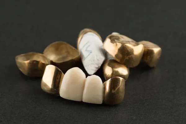 Σφραγισμένες Οδοντιατρικές Γέφυρες Καλυμμένες Χρυσό Επιχρισμένες Μαύρο Φόντο — Φωτογραφία Αρχείου