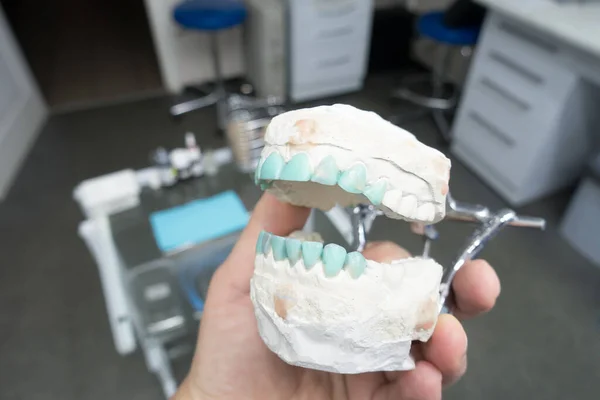Modélisation Dents Artificielles Sur Modèle Plâtre Pour Affichage Visuel — Photo