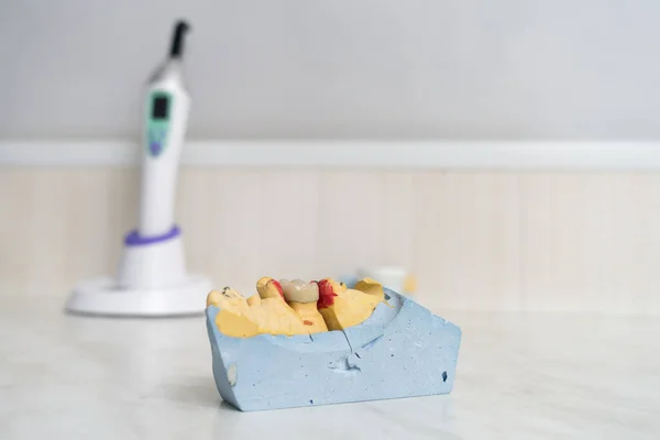 Dental Ceramic Crown Plaster Model Stands Tabl — Stock Photo, Image