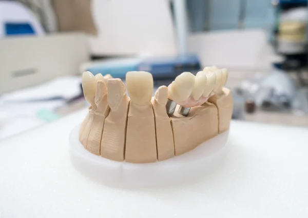 Miejsce Pracy Technika Dentystycznego Produkcji Protez Dentystycznych Implantach — Zdjęcie stockowe