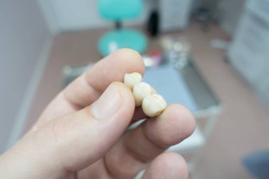 dental ceramic metal bridges in the hands of a docto clipart