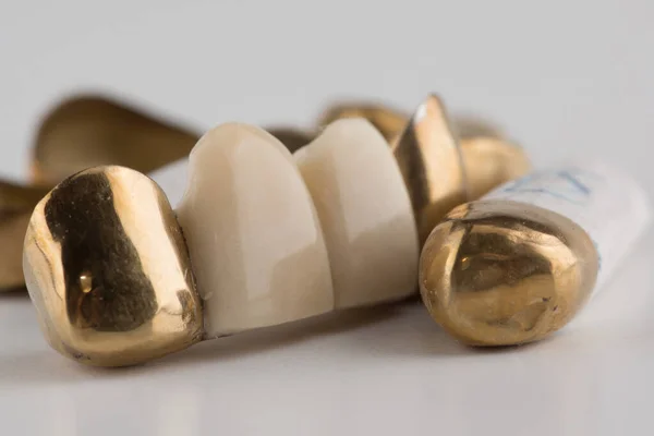 Puentes Dentales Soldados Estampados Recubiertos Oro Sobre Fondo Blanco — Foto de Stock