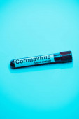 Magas szögű kilátás kémcső koronavírus vérmintát kék