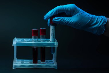 Koronavirüs aşısı olan örnek tüplerle erkek elinin kırpılmış görüntüsü ve test tüpündeki kan koyu renkli raflarda.