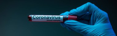Bilim adamının yatay mahsulü, üzerinde koronavirüs kan örneği olan test tüpü gösteriyor.