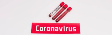 Beyaz üzerinde kan örnekleri olan test tüplerinin yanında Coronavirus harfleri yazan bir site başlığı 