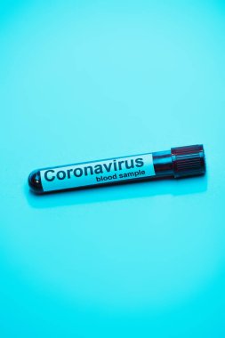 Mavi üzerinde koronavirüs kan örneği olan test tüpünün yüksek açılı görüntüsü