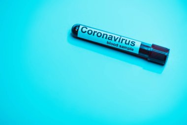Mavi zemin üzerinde koronavirüs kan örneği olan test tüpünün yüksek açılı görüntüsü