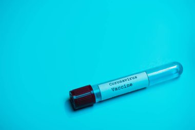 Mavi üzerinde koronavirüs aşısı olan test tüpünün yüksek açılı görüntüsü 