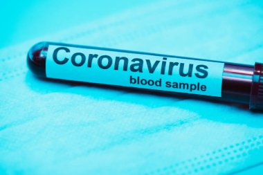 Mavi arka planda koronavirüs kan örneği olan test tüpü.